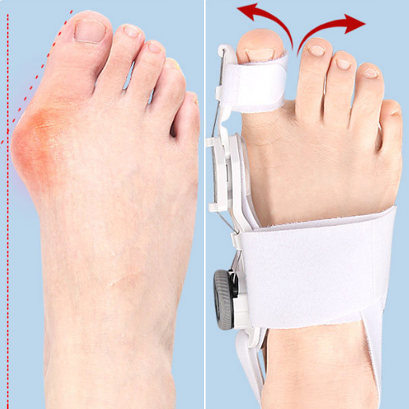 LIMETOW® Bunion Corrector
